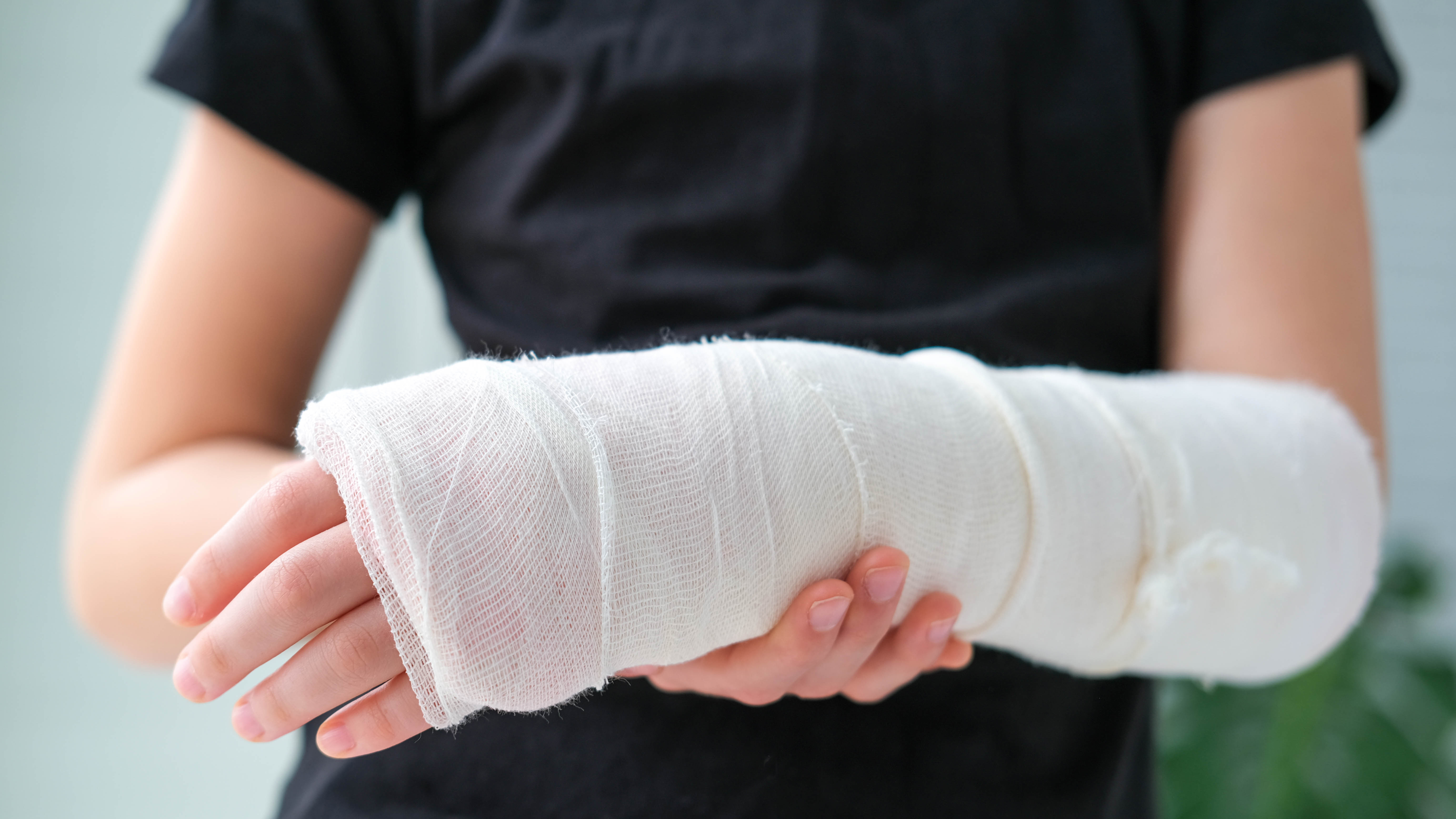 Close up photo of a person with a broken arm